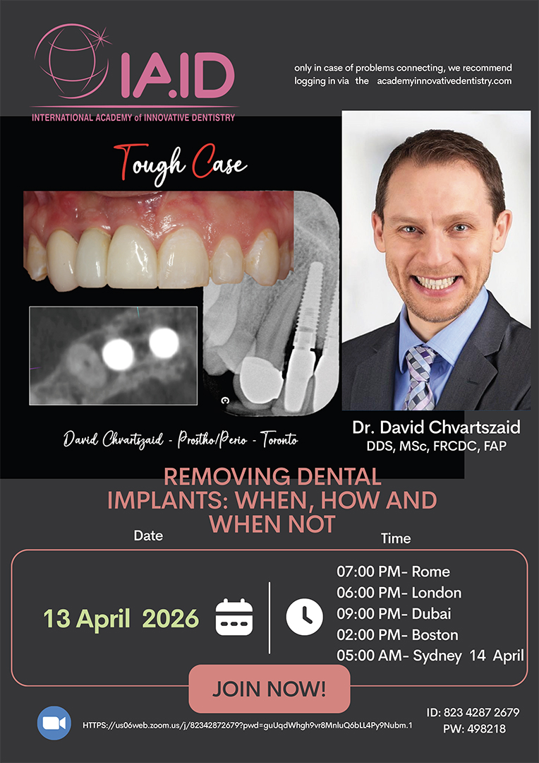 Removing Dental Implants